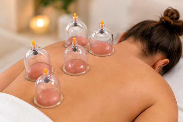 Dry Cupping 1 day Course (Kit included)